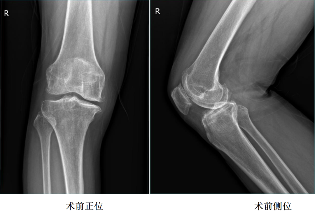 手术视频