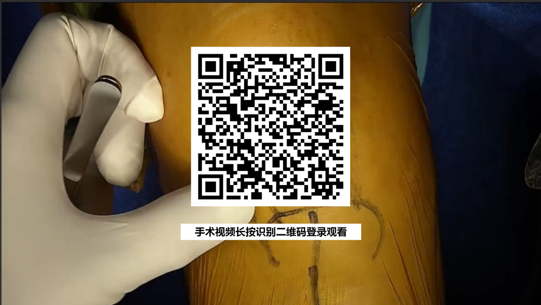 手术视频