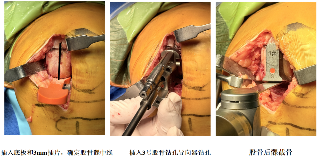 手术视频