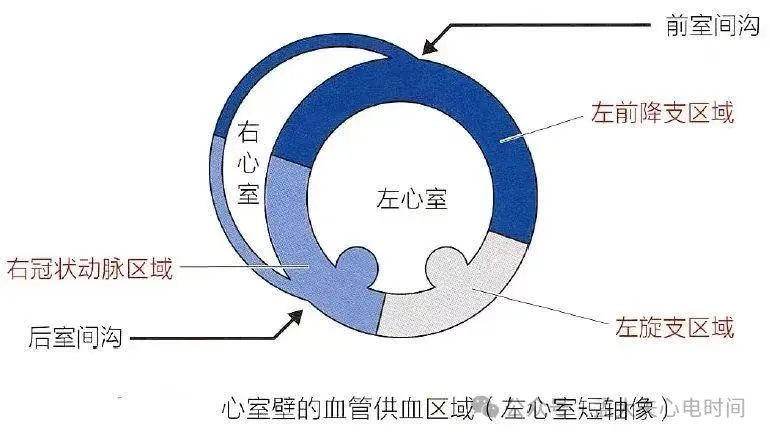 一文系统化学习--前壁心肌梗死定位、命名和诊断