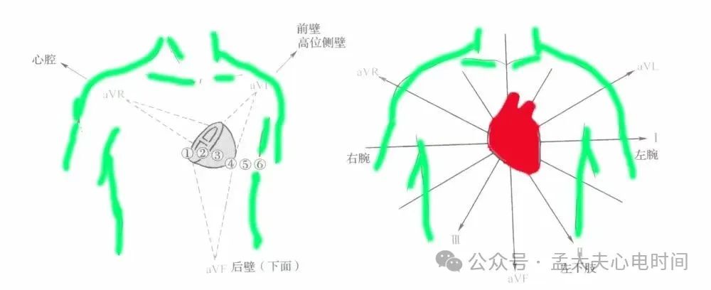 一文系统化学习--前壁心肌梗死定位、命名和诊断