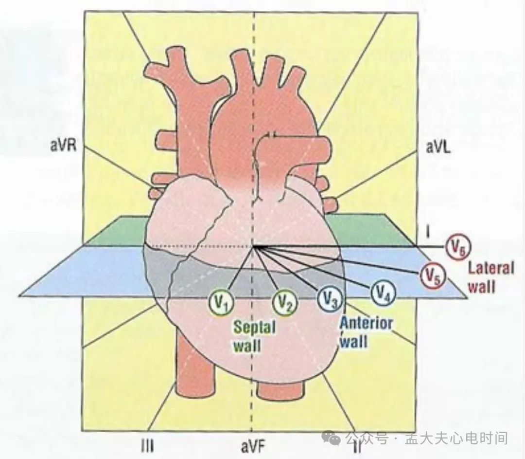 一文系统化学习--前壁心肌梗死定位、命名和诊断