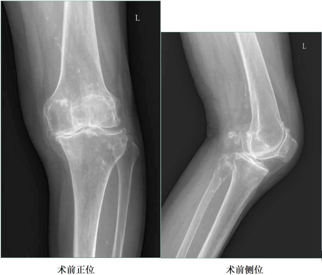 手术视频