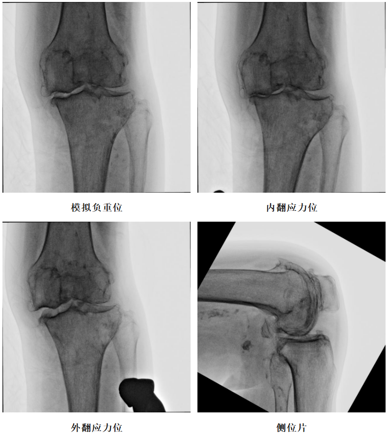 手术视频