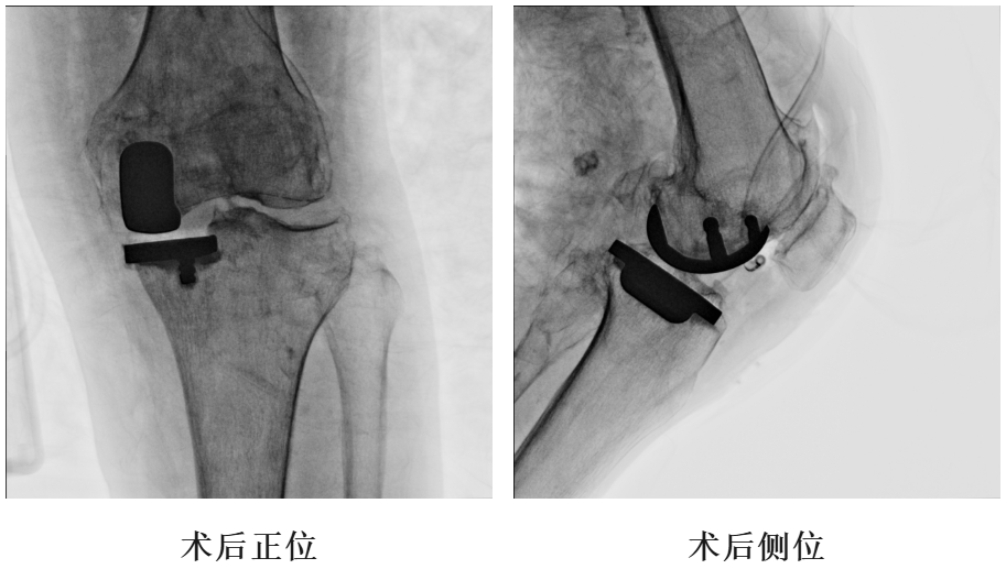 手术视频