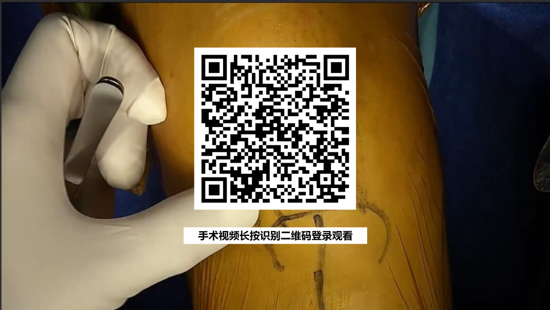手术视频