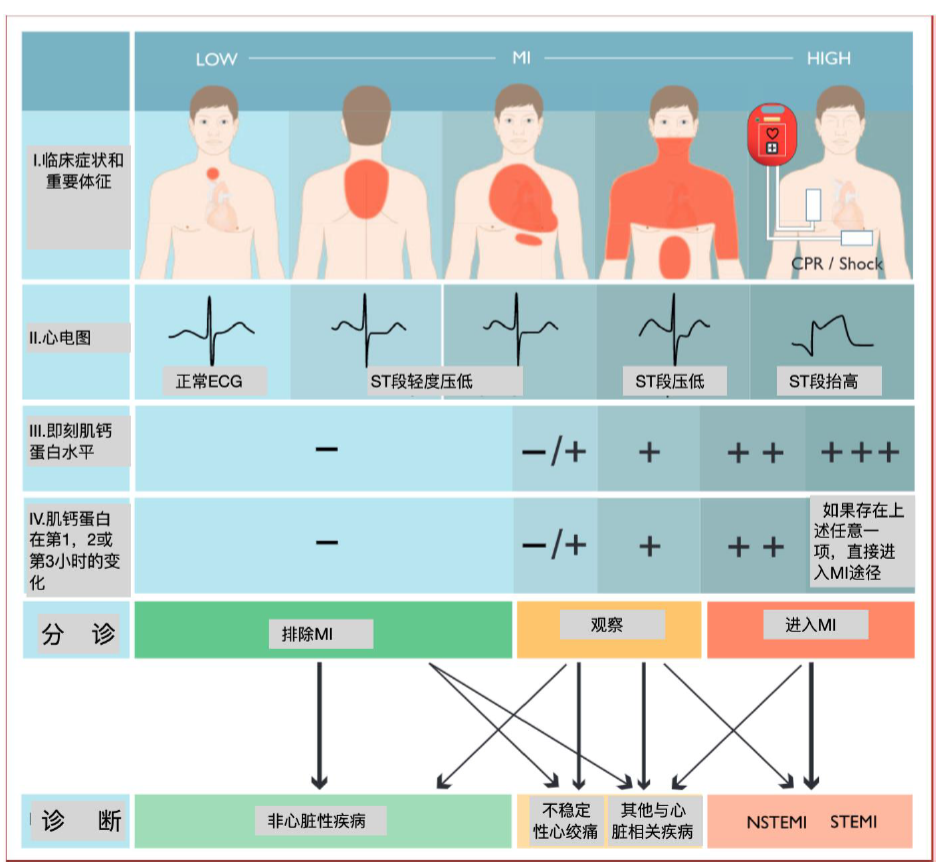 急性冠脉综合征患者的识别与救治