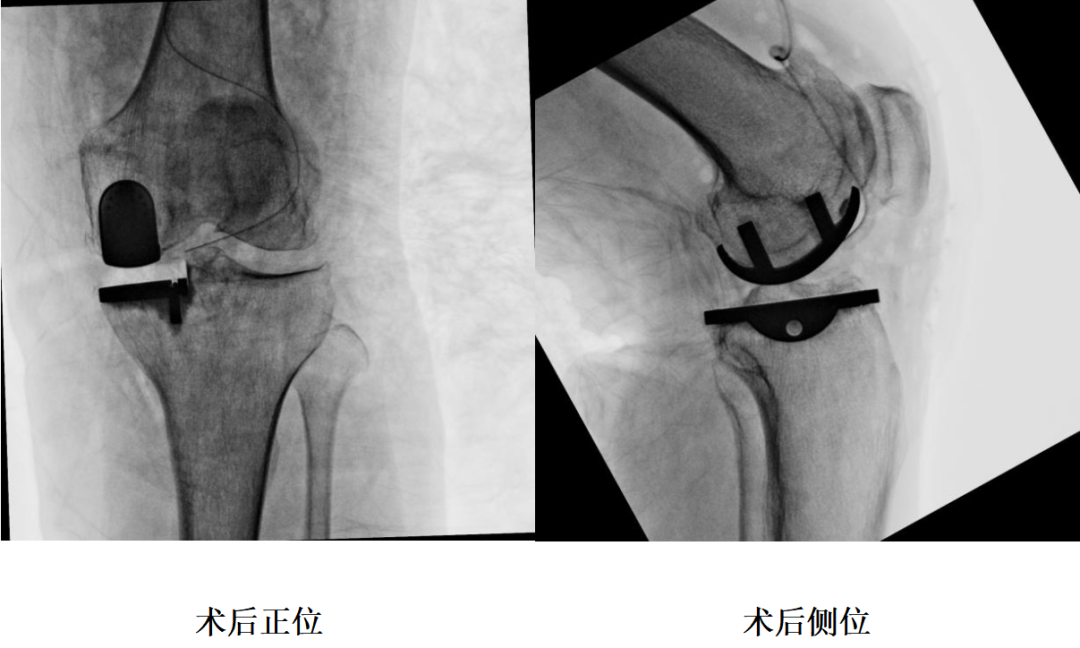 手术视频