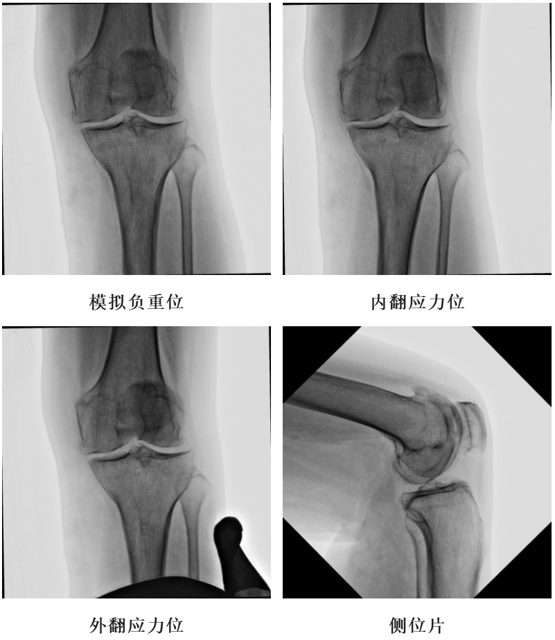 手术视频