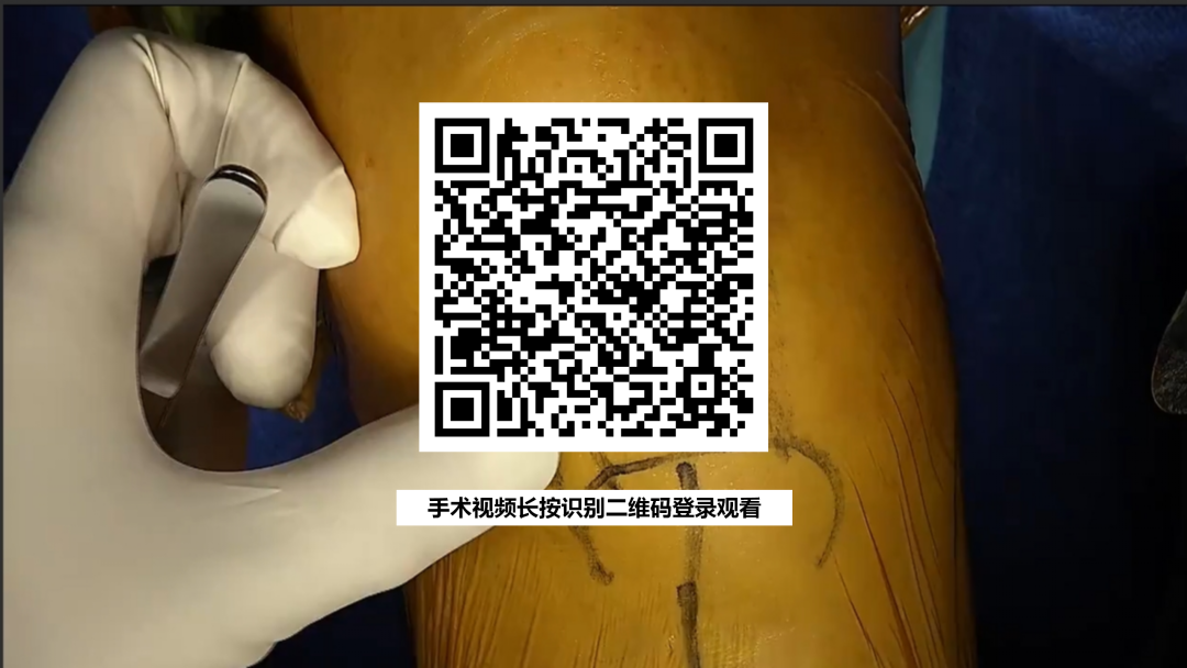 手术视频