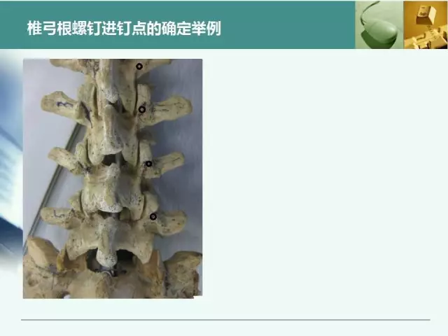 胸腰椎椎弓根置钉技术，很全很实用！