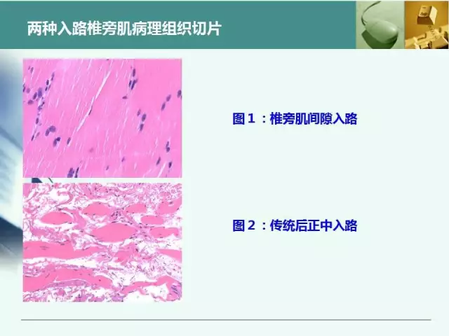 胸腰椎椎弓根置钉技术，很全很实用！