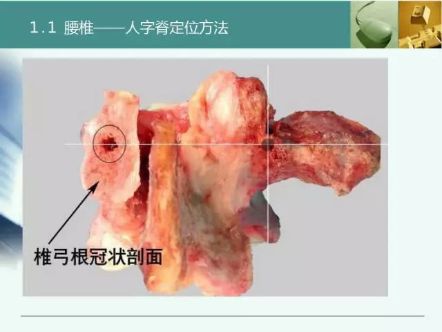 胸腰椎椎弓根置钉技术，很全很实用！