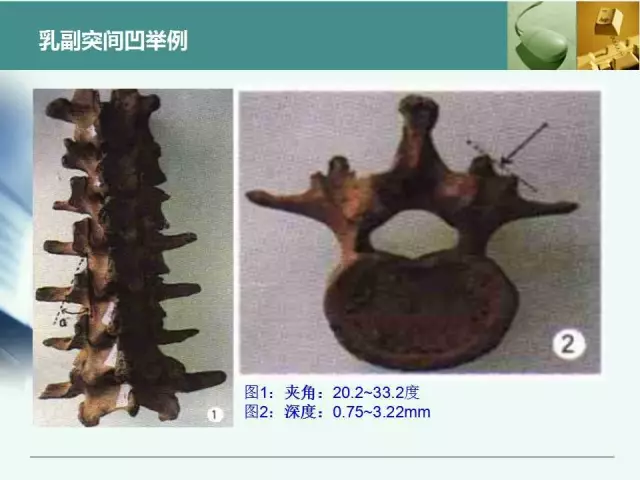 胸腰椎椎弓根置钉技术，很全很实用！