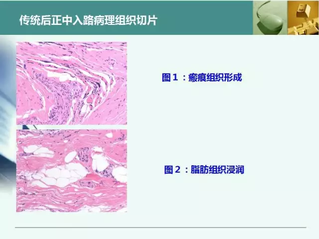 胸腰椎椎弓根置钉技术，很全很实用！