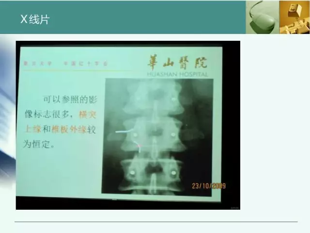 胸腰椎椎弓根置钉技术，很全很实用！