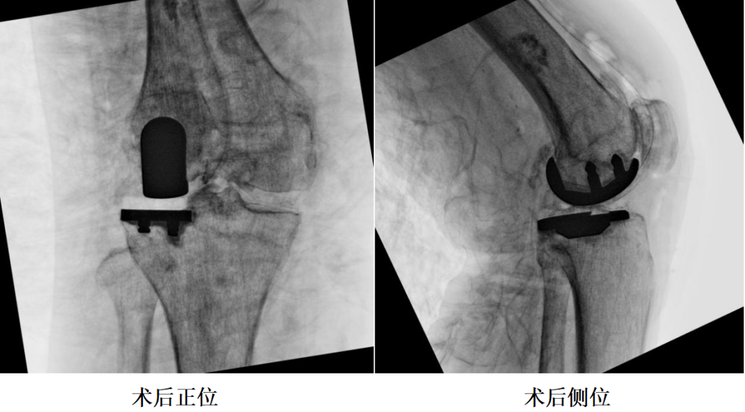 手术视频