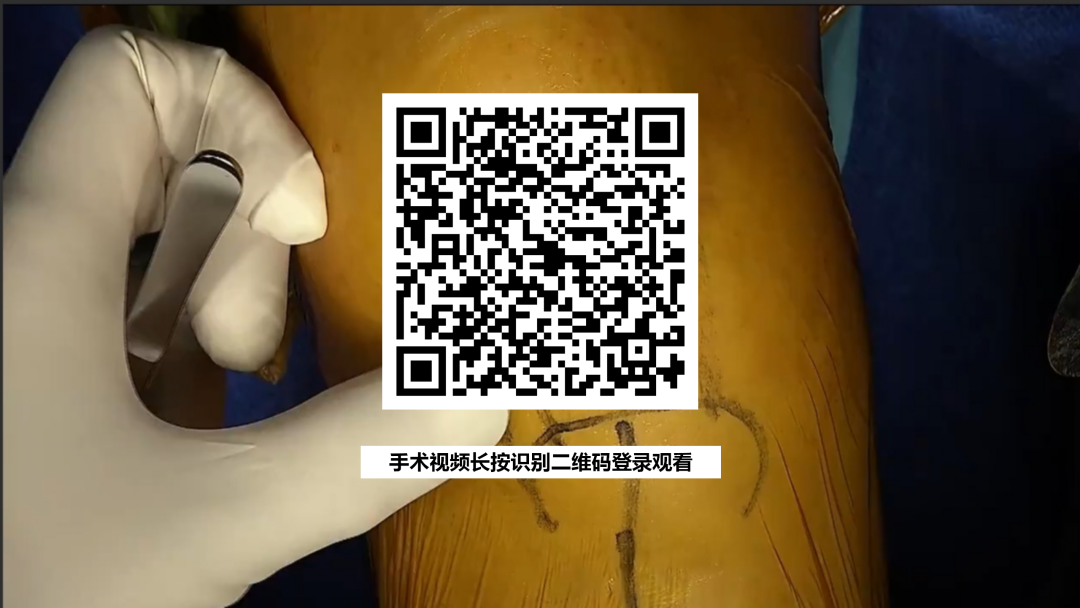 手术视频