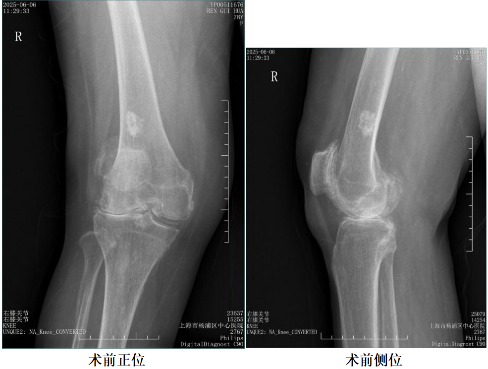 手术视频