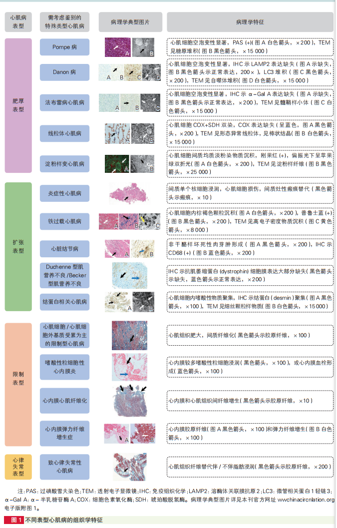 心肌病防治步入精准化、规范化、全程化管理,中国首部心肌病综合管理指南发布