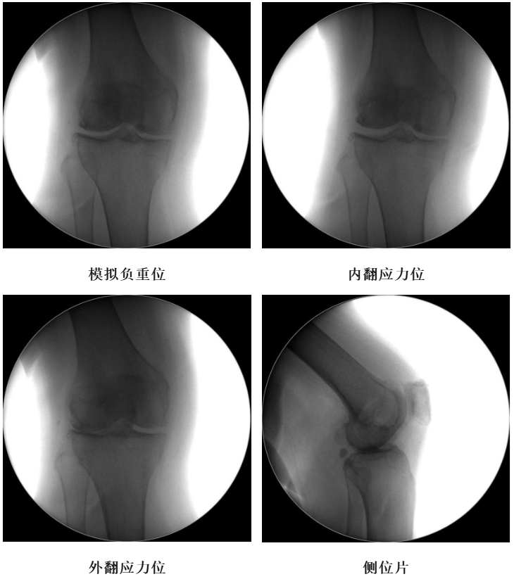 手术视频