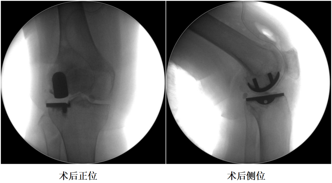 手术视频