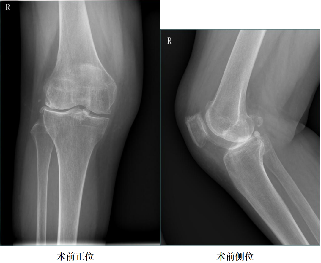 手术视频