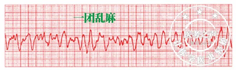 常见心律失常的急诊处理(心血管医生值班必备)