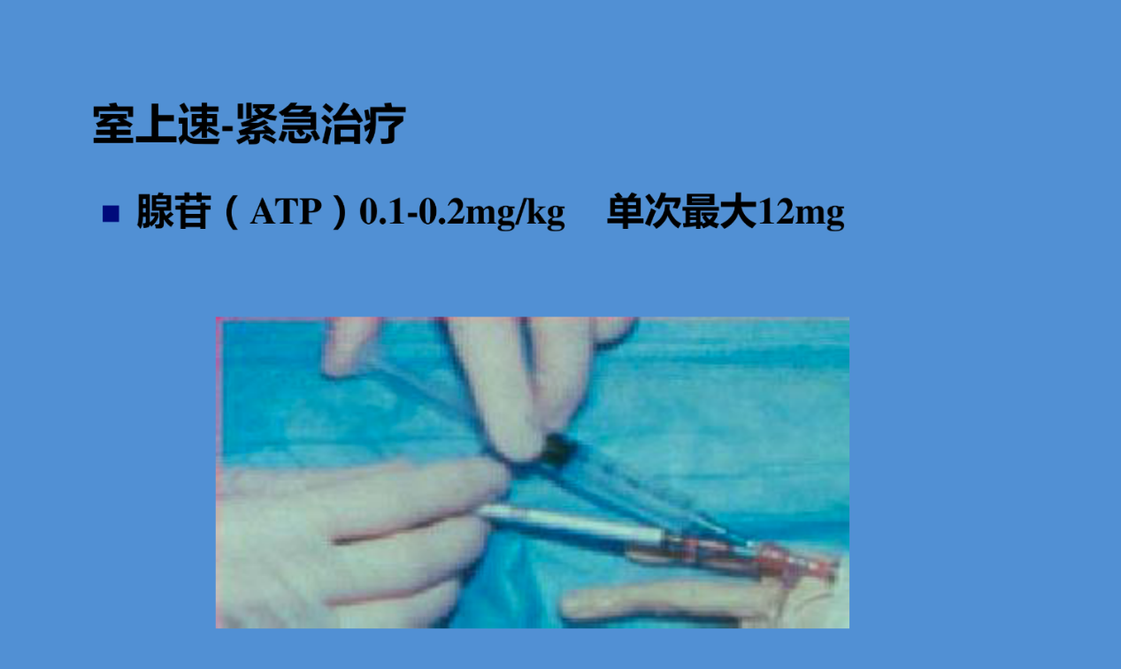 恶性心律失常的急诊识别与处理(含ppt详解)