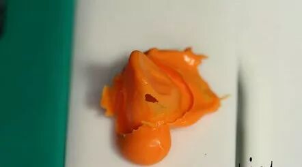 如何采用硅橡胶快速去除戴牙支点