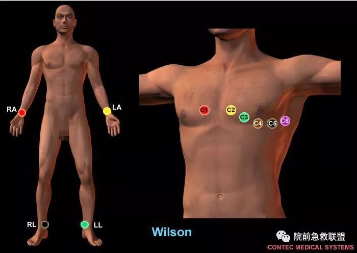 心律失常——房颤患者的紧急处置