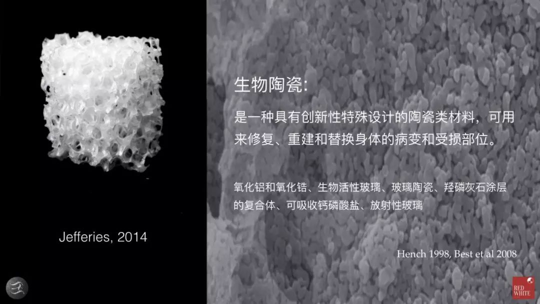 三种根充材料临床使用效果对比,你常用的是哪种?