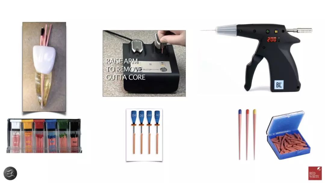 三种根充材料临床使用效果对比,你常用的是哪种?