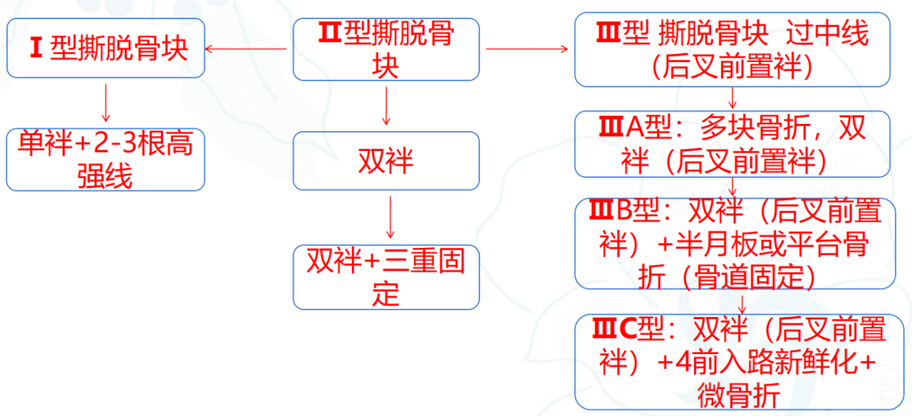 镜下双袢联合高强线“三重”固定后交叉胫骨止点撕脱骨折及分型