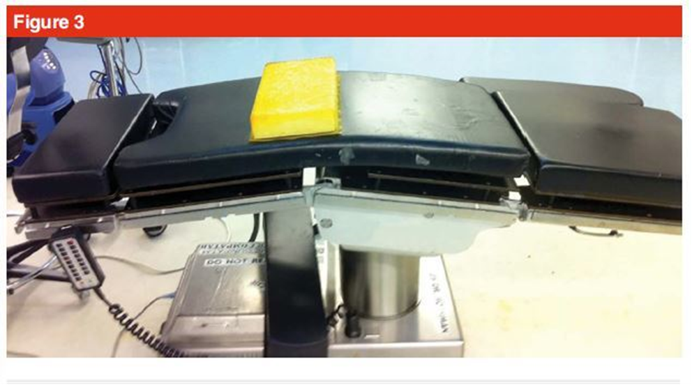 手术技巧:人工髋关节置换术,骨科医生须掌握!