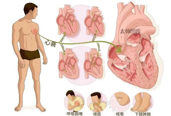 关于心衰诊断标志物—BNP，总结全了
