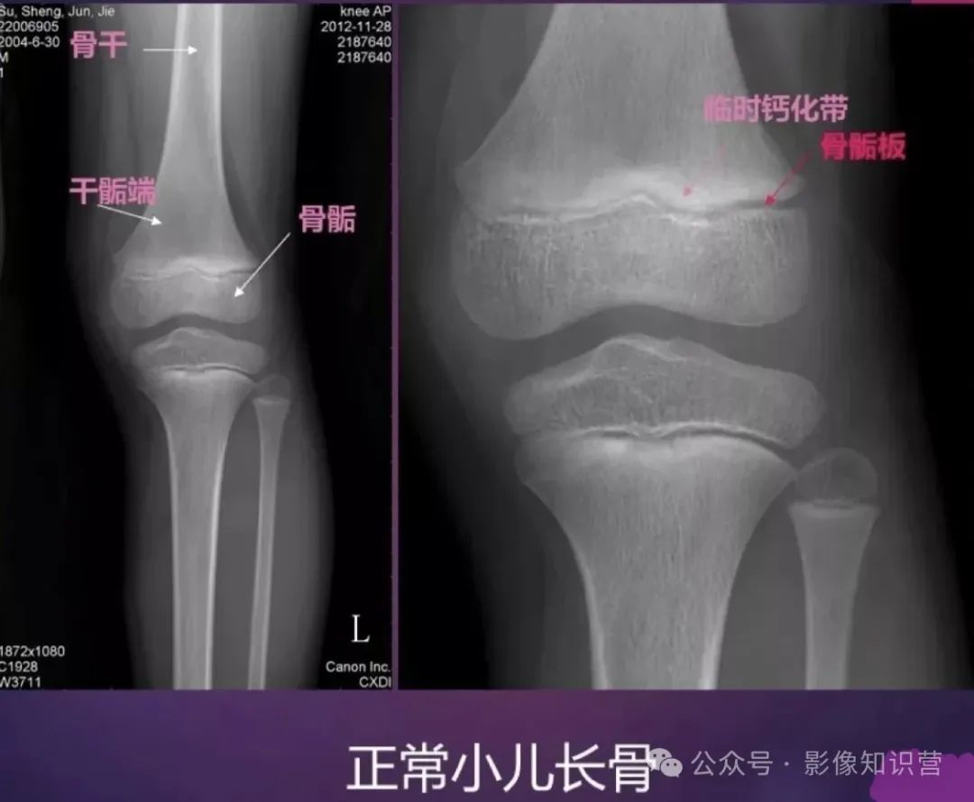 四肢骨骼影像解剖,一文掌握!