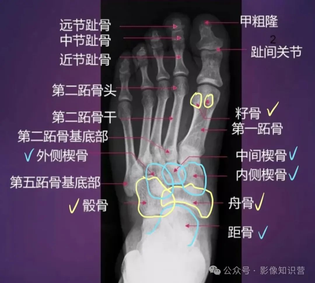 四肢骨骼影像解剖,一文掌握!