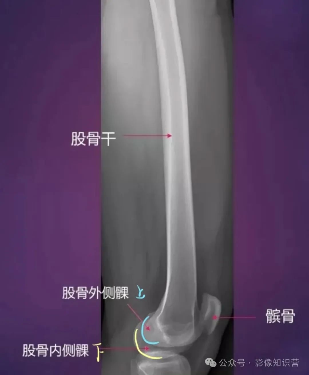 四肢骨骼影像解剖,一文掌握!