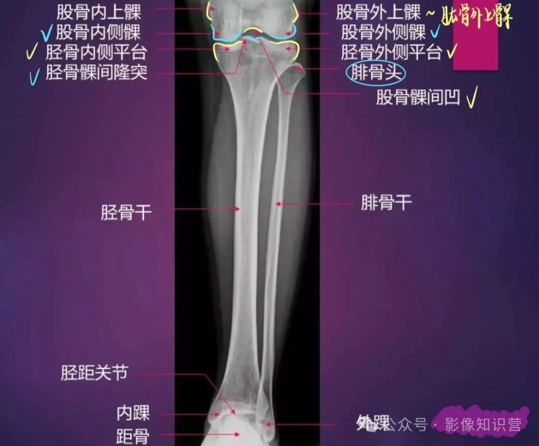 四肢骨骼影像解剖,一文掌握!