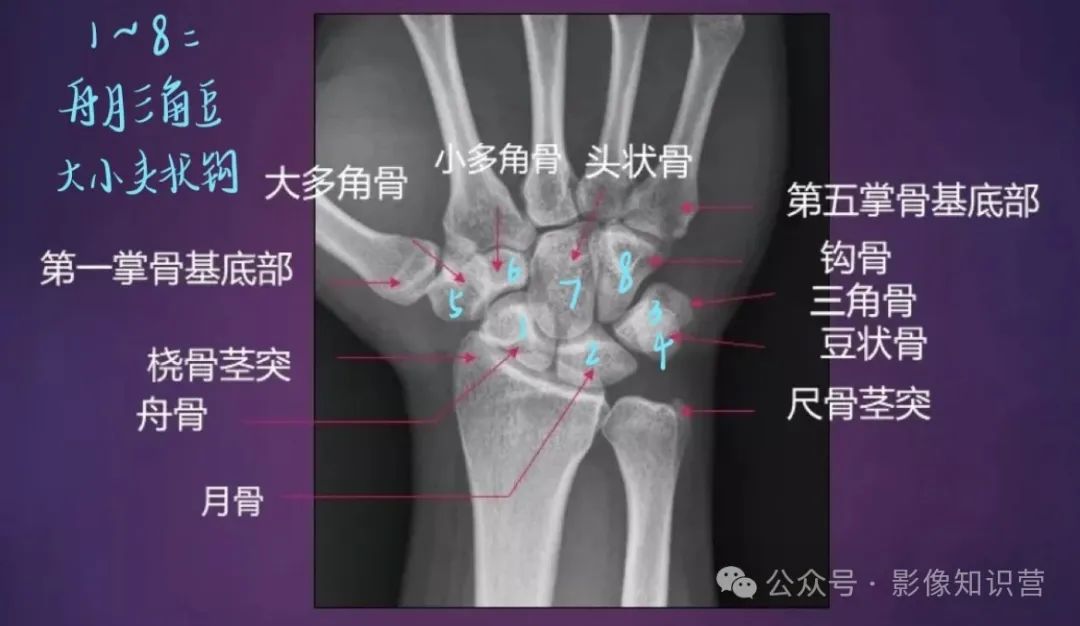 四肢骨骼影像解剖,一文掌握!