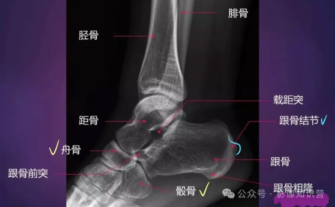四肢骨骼影像解剖,一文掌握!
