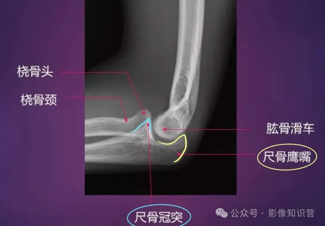 四肢骨骼影像解剖,一文掌握!