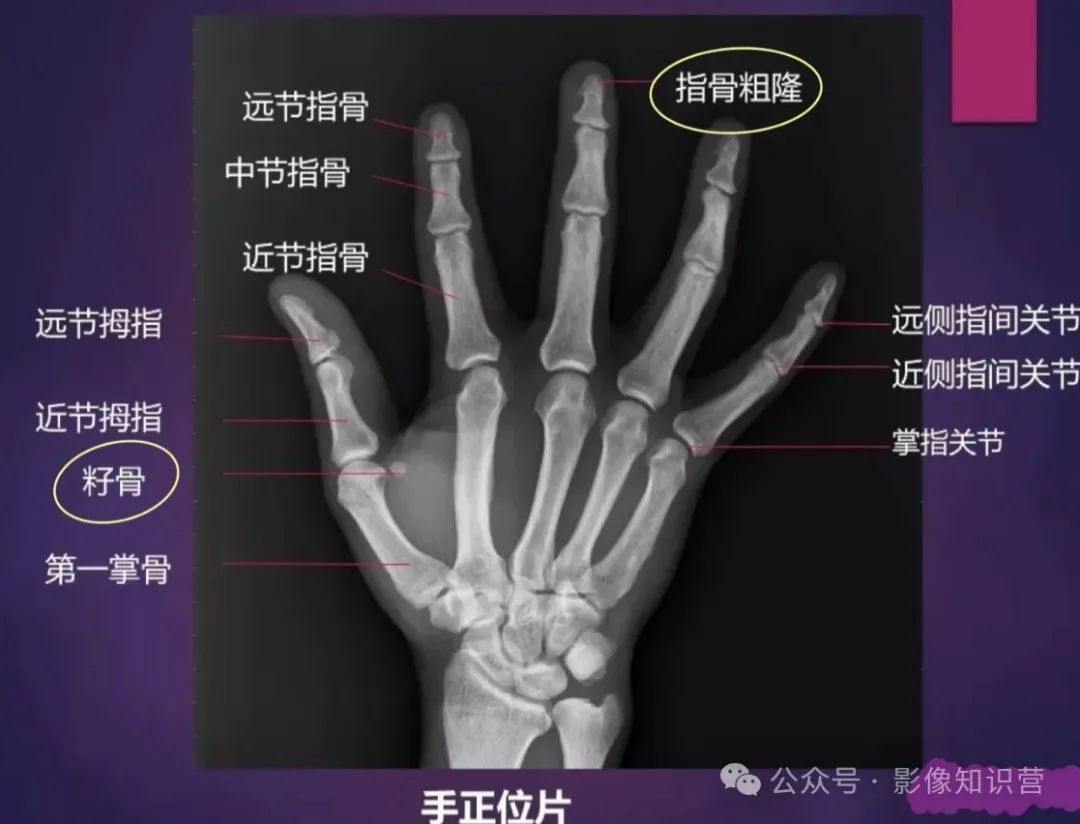 四肢骨骼影像解剖,一文掌握!