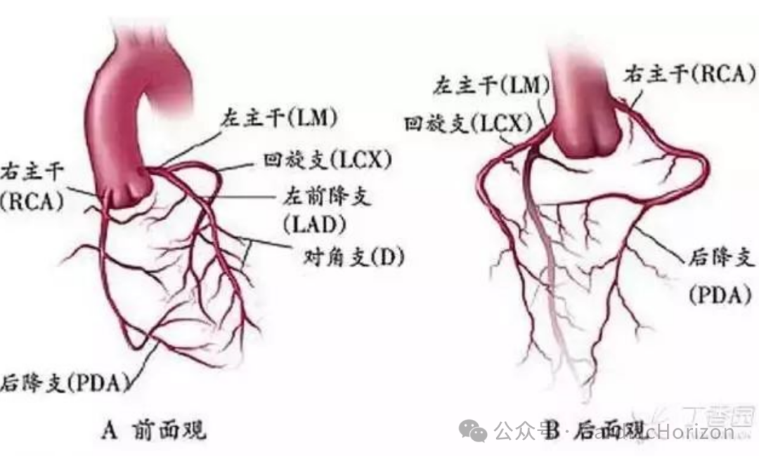 如何快速定位急性心肌梗死罪犯血管,这篇文章教会你