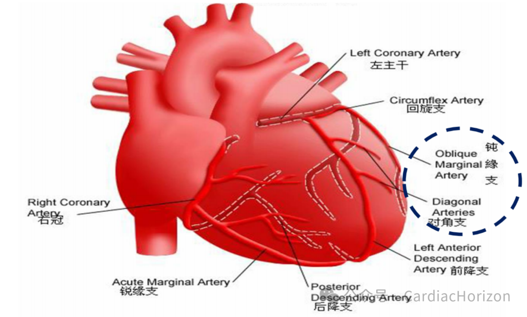 如何快速定位急性心肌梗死罪犯血管,这篇文章教会你