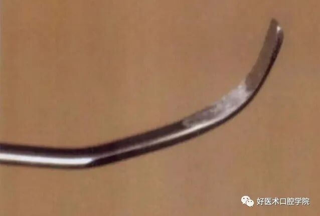 牙周刮治技术,从检查到操作方法,全套要点总结!