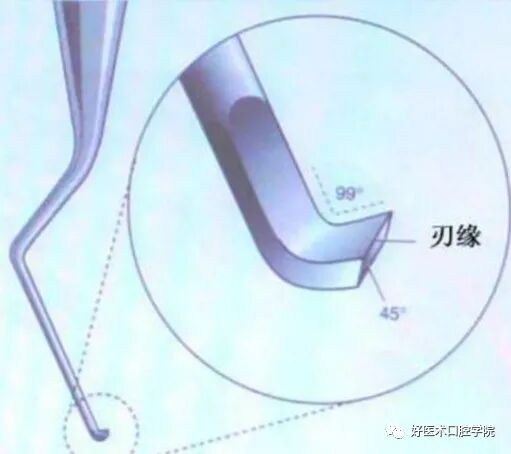 牙周刮治技术,从检查到操作方法,全套要点总结!