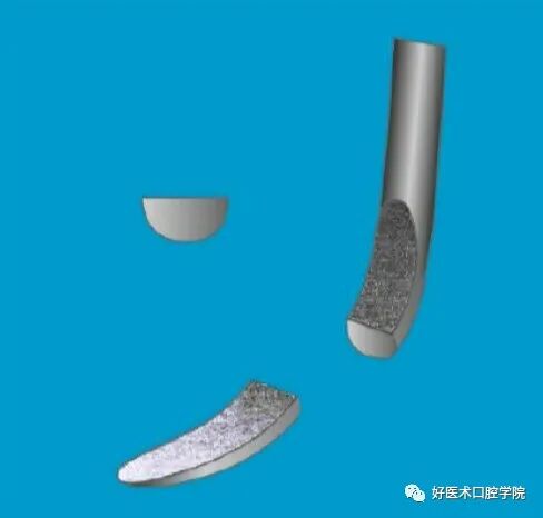 牙周刮治技术,从检查到操作方法,全套要点总结!