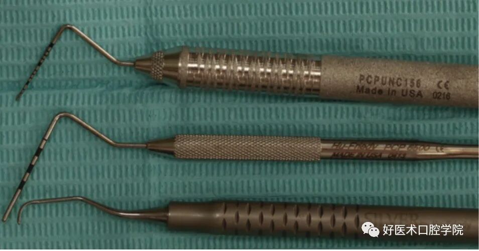 牙周刮治技术,从检查到操作方法,全套要点总结!